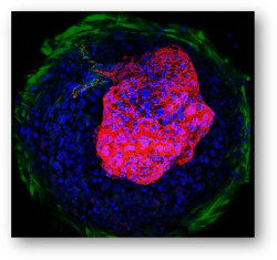 Coraz&oacute;n en miniatura, por Dr. Jos&eacute; Manuel Revuelta