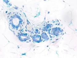 Descubren una conexi&oacute;n entre senescencia y c&eacute;lulas madre provocada por una prote&iacute;na iniciadora del c&aacute;ncer de mama