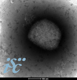 El ISCIII obtiene la secuencia completa del genoma del virus de la viruela del mono