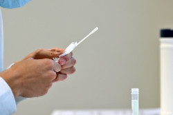 El n&uacute;mero de casos de COVID-19 en Europa baja un 22% en la &uacute;ltima semana de julio, seg&uacute;n el ECDC