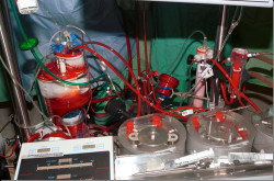 En busca de la sangre perdida, por el Dr. Jos&eacute; Manuel Revuelta Soba