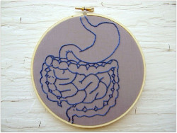 La inteligencia artificial podr&iacute;a mejorar los resultados de los pacientes con c&aacute;ncer de intestino