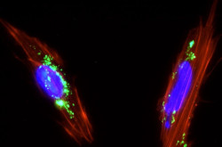 Las c&eacute;lulas madre mesenquimales humanas, prometedoras en el tratamiento de infecciones pulmonares cr&oacute;nicas