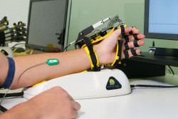 Neur&oacute;logo se&ntilde;ala que la neurorrehabilitaci&oacute;n permite "mejorar limitaciones motoras" en momentos concretos del Parkinson